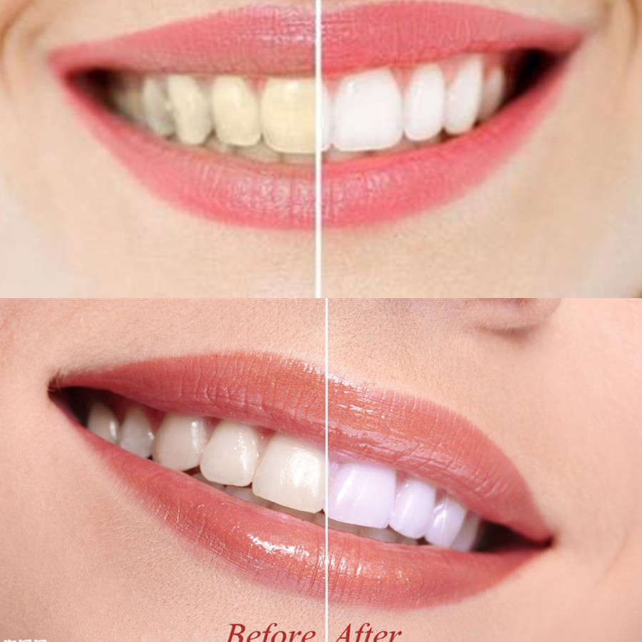 Bamboo Charcoal Teeth Tooth De - Teeth Whitening Remedies ulasan dan harga