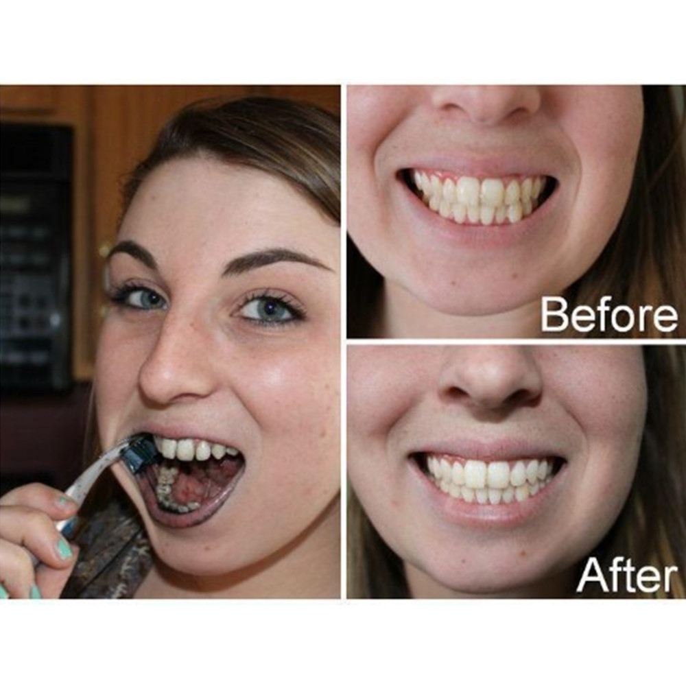 Bamboo Charcoal Teeth Tooth De - Teeth Whitening Remedies ulasan dan harga