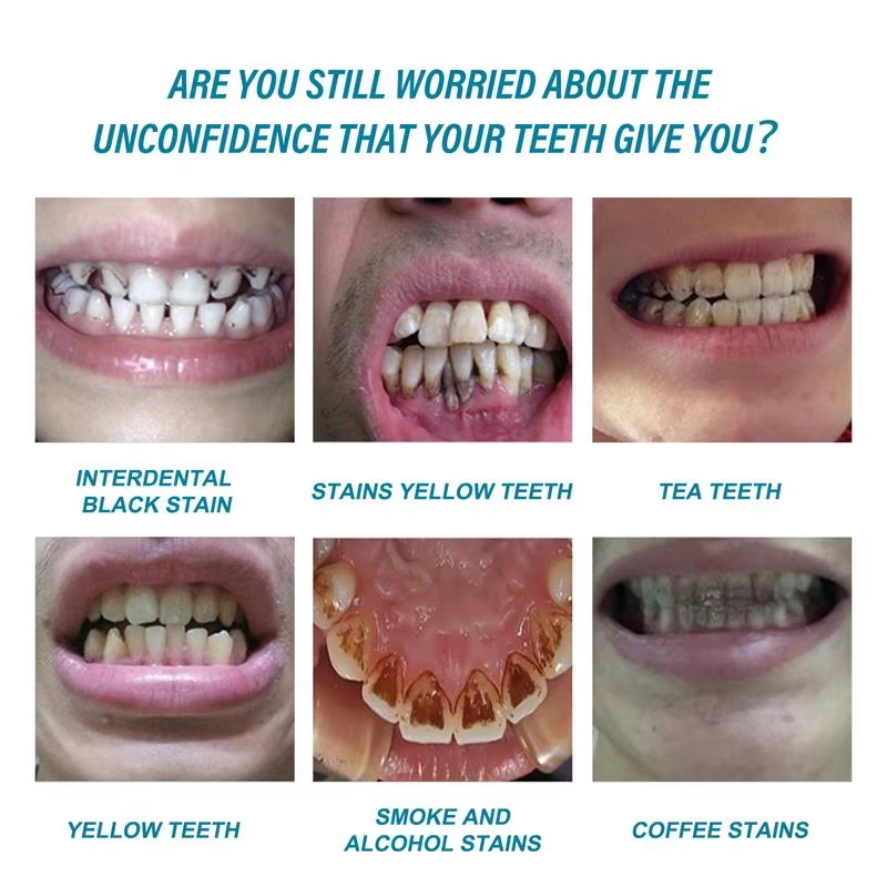 Teeth Whitening Essence Remove - Teeth Whitening Serum ulasan dan harga