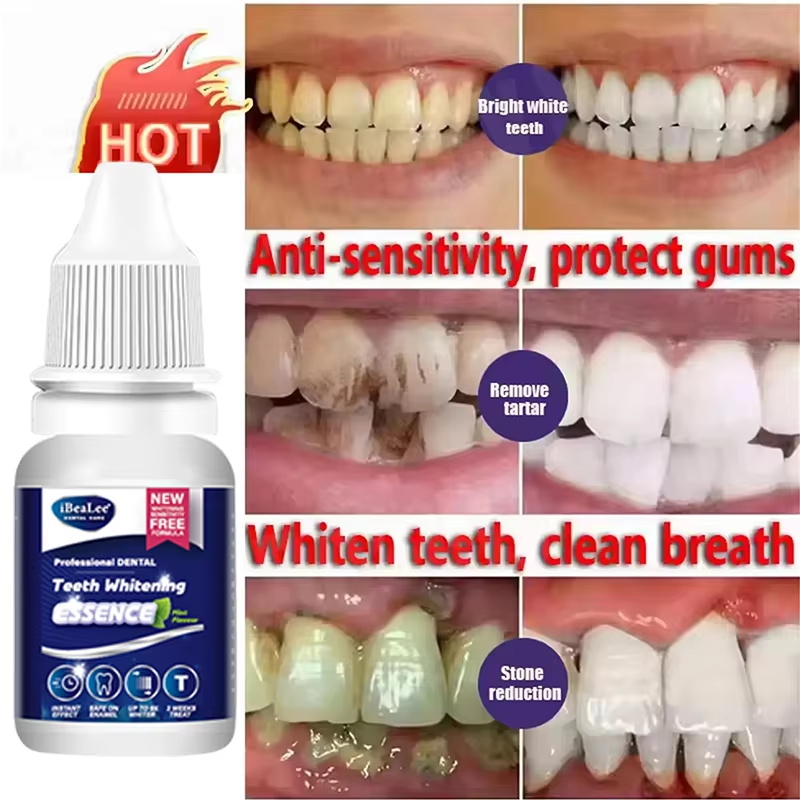 Teeth Whitening Essence Remove - Teeth Whitening Serum ulasan dan harga