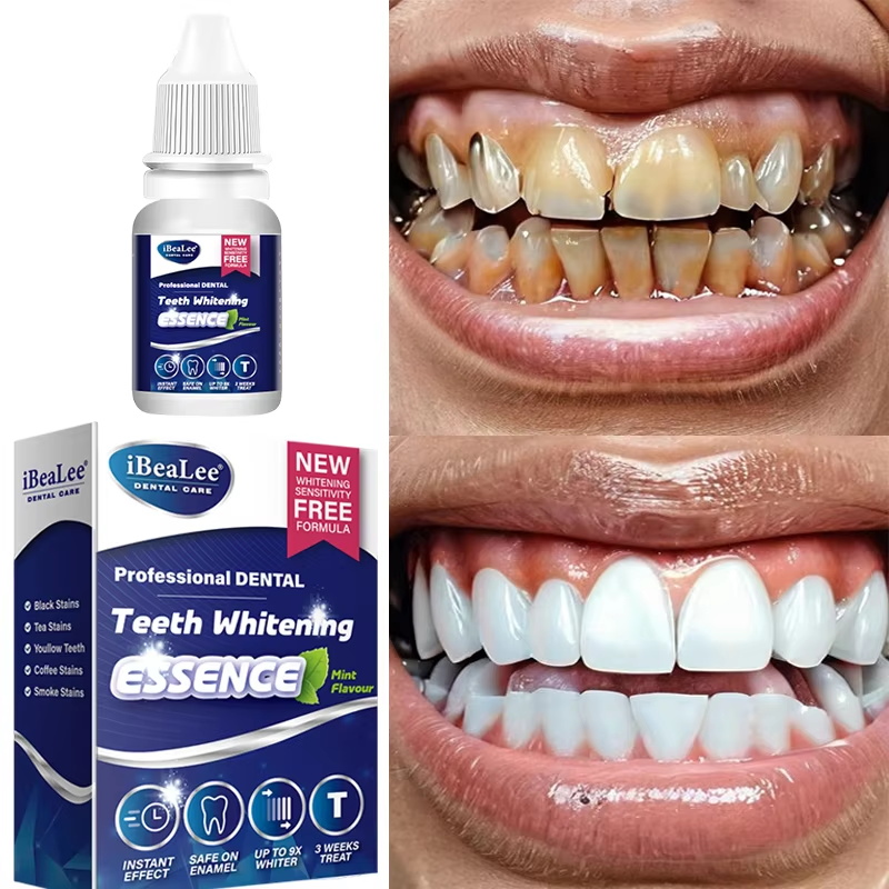 Teeth Whitening Essence Remove - Teeth Whitening Serum ulasan dan harga