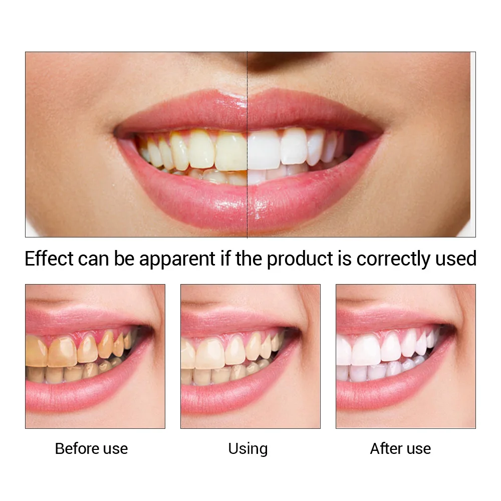 FTEENPLY Teeth Whitening Essen - Teeth Whitening Paste ulasan dan harga