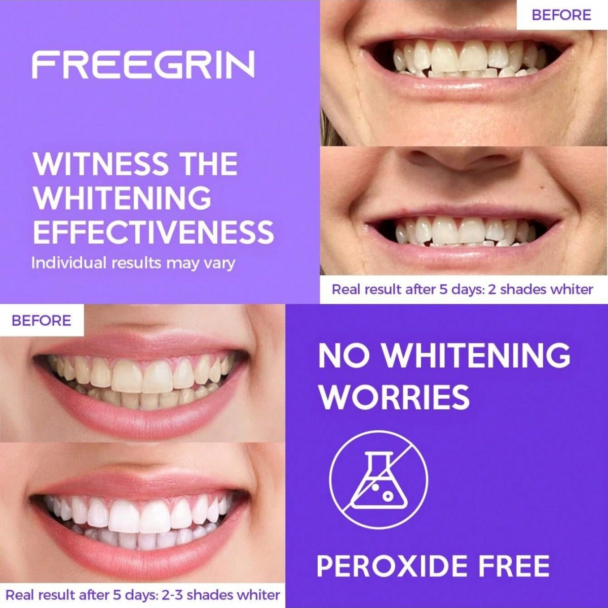 Deluxe Whitening Teeth Sticker - Teeth Whitening With Hydrogen Peroxide ulasan dan harga