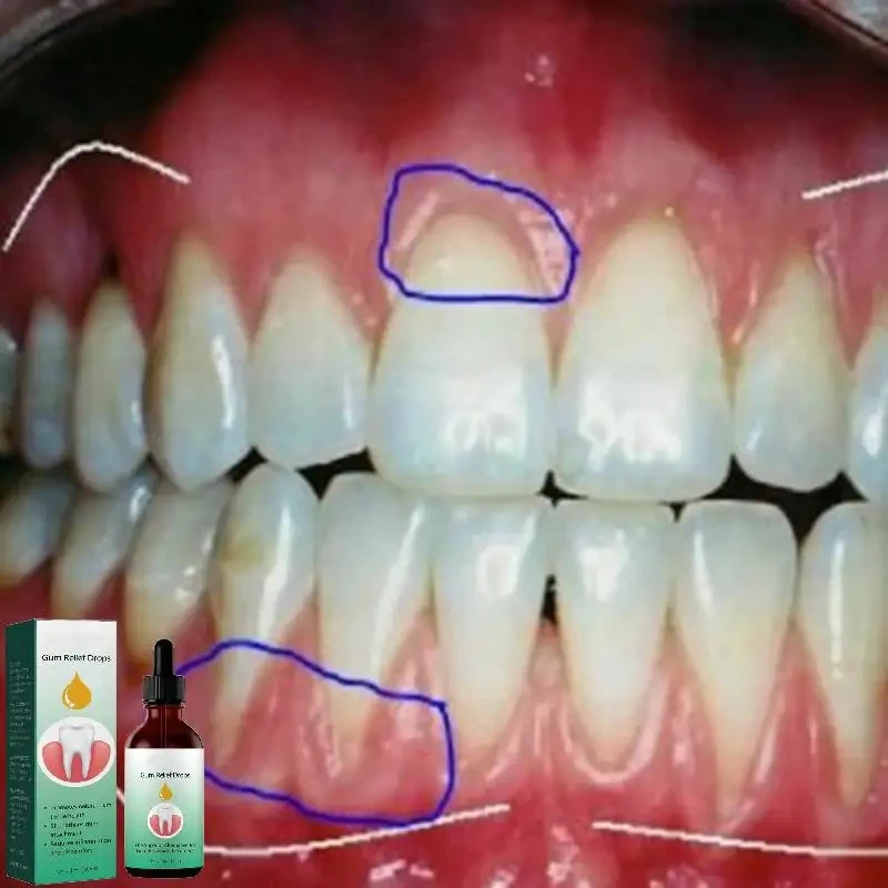 Gum Repair Drops Relieve Reced - Teeth Whitening Paste ulasan dan harga