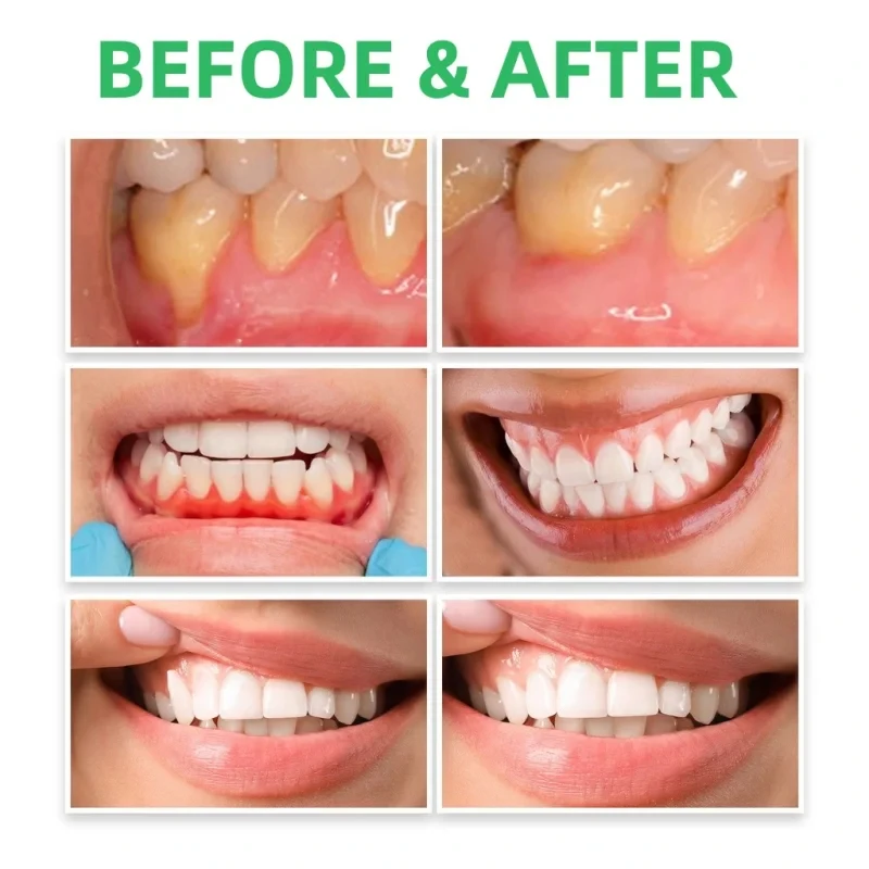 Gum Repair Drops Relieve Reced - Teeth Whitening Paste ulasan dan harga