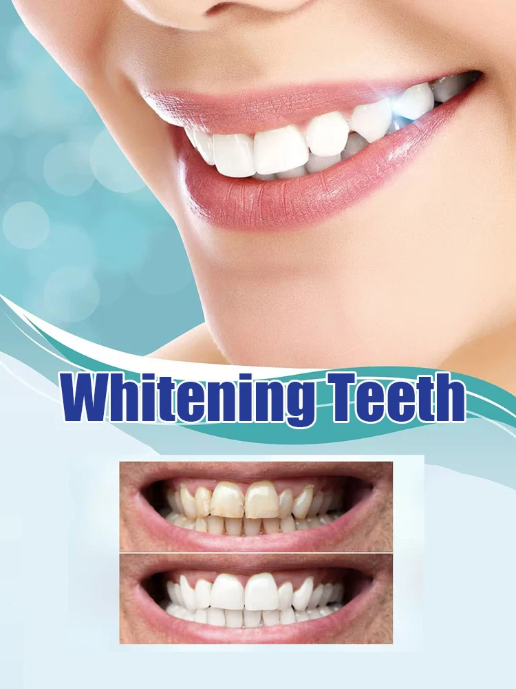 Newly Upgraded Teeth Whitening - Teeth Whitening Serum ulasan dan harga