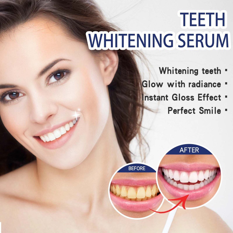 Professional Teeth Brightening - Teeth Whitening Serum ulasan dan harga